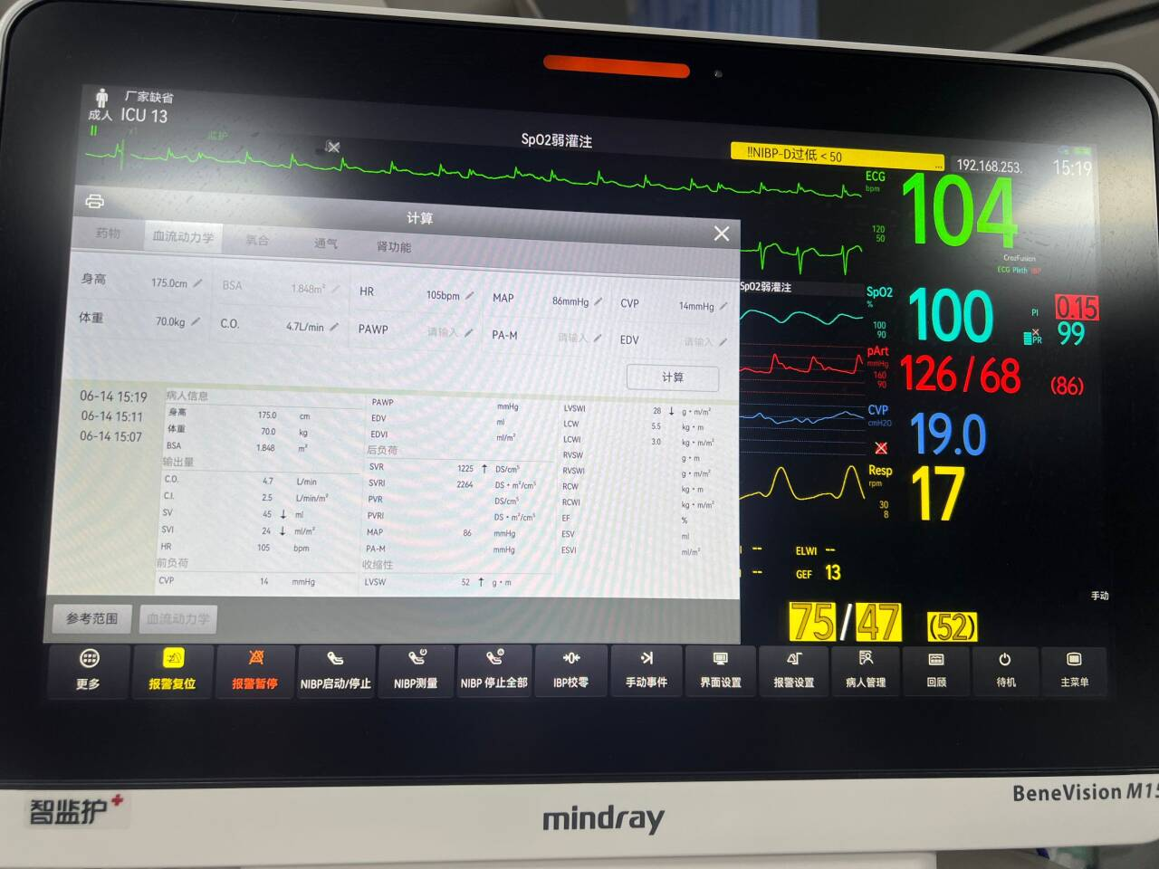 ҽԺICUŶӳɹչPICCO⼼